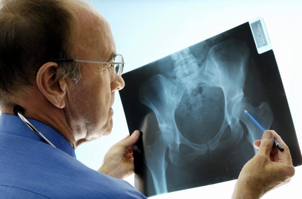 Orthopedic surgeon looking at X-ray